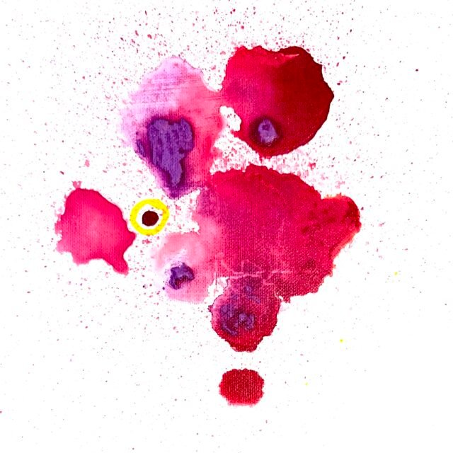 E: Echo